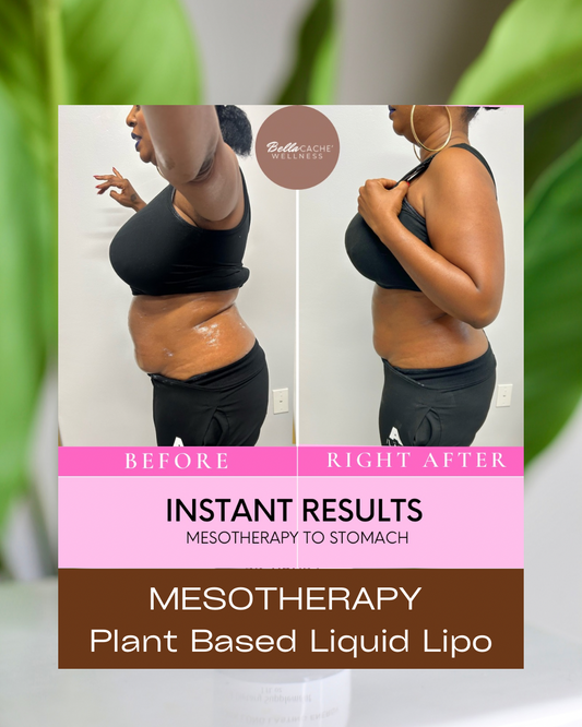 Mesotherapy